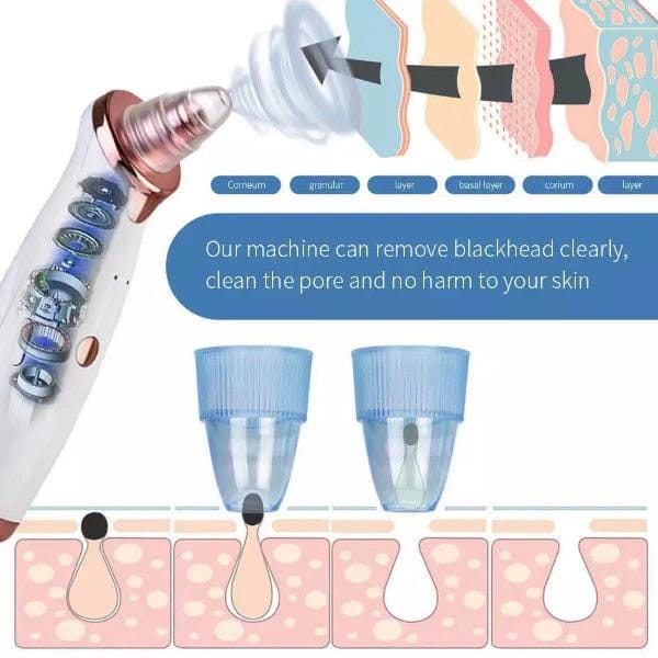 Black Head Remover Machine 5 In 1 (Rechargeable)