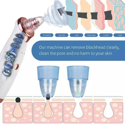 Black Head Remover Machine 5 In 1 (Rechargeable)